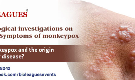 Epidemiological investigations on Signs and Symptoms of monkeypox
