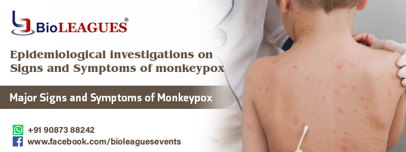 Major Signs and Symptoms of monkeypox